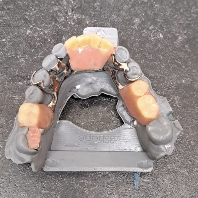 partial-dentures