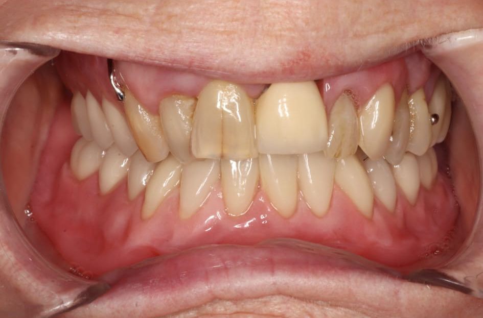 smile-trans