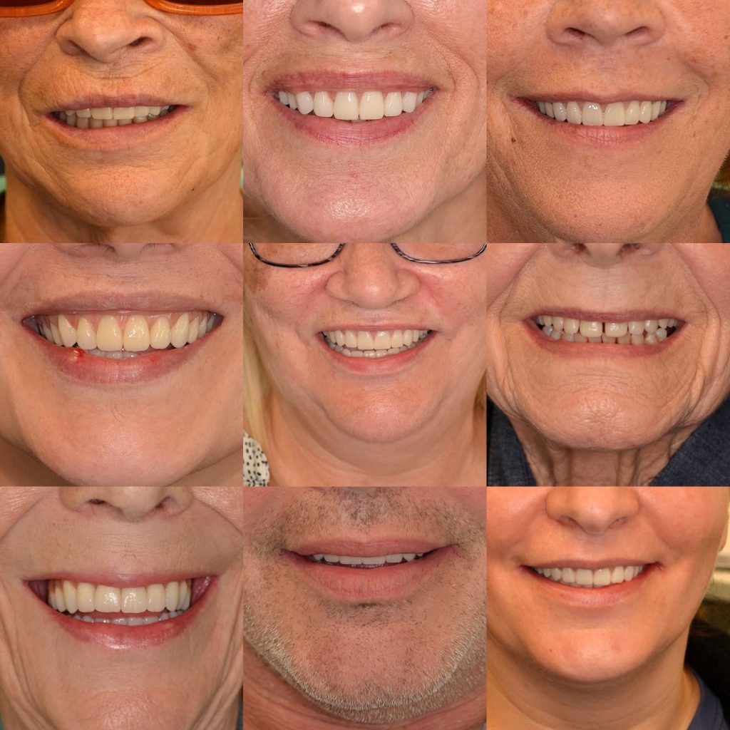 smiles